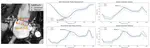 Fully automatic extraction of mitral valve annulus motion parameters on long axis CINE CMR using deep learning