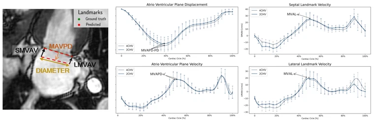 Mitral Valve Annulus Motion Parameter Extraction