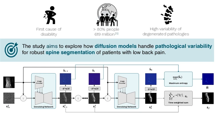 SpineSegDiff — Diffusion Models for Spine MRI Segmentation