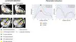 Fully automated AI-based cardiac motion parameter extraction – application to mitral and tricuspid valves on long-axis cine MR images