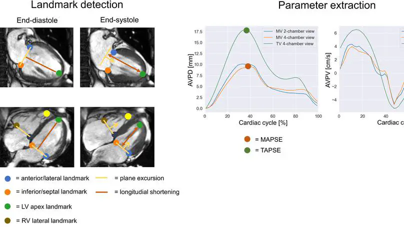 Fully automated AI-based cardiac motion parameter extraction – application to mitral and tricuspid valves on long-axis cine MR images