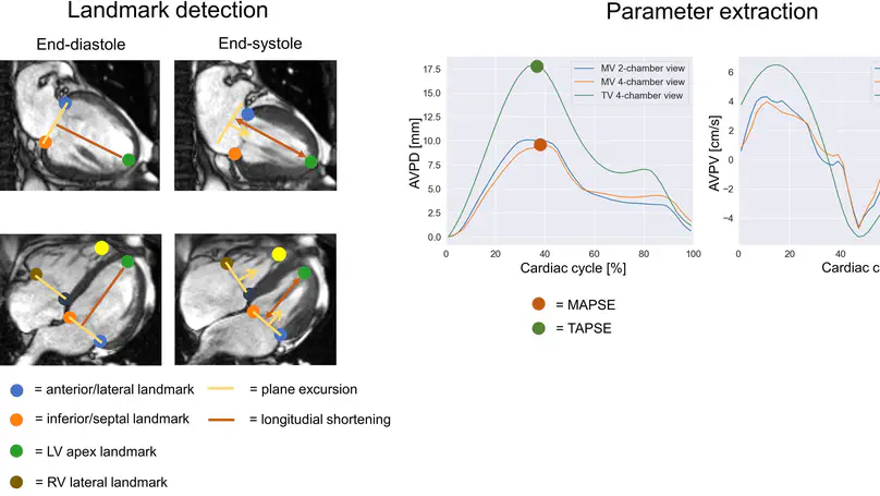 Fully automated AI-based cardiac motion parameter extraction – application to mitral and tricuspid valves on long-axis cine MR images