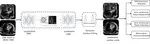 Fully automatic extraction of mitral valve annulus motion parameters on long axis CINE CMR using deep learning