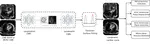 Fully automatic extraction of mitral valve annulus motion parameters on long axis CINE CMR using deep learning