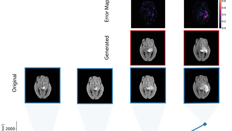 Predicting Anatomical Tumor Growth in Pediatric High-grade Gliomas via Denoising Diffusion Models