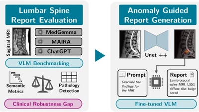 Beyond Fluency: A Clinical Benchmark and Anomaly-Enhanced Baseline for Spine MRI Report Generation featured image