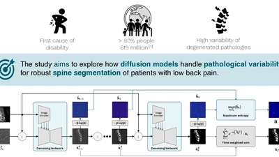 Enhancing Low Back Pain Assessment with Diffusion Models for Lumbar Spine MRI Segmentation featured image